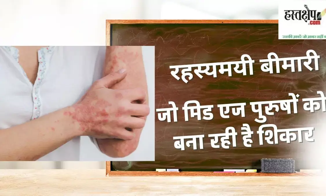 What is Vaxas disease? Complete information about causes, symptoms, risks and treatment