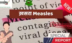 ख़सरा (Measles in Hindi)