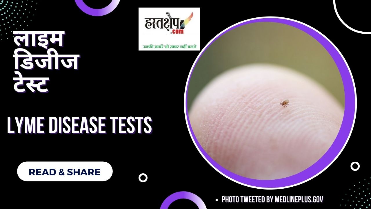 जानिए लाइम रोग परीक्षण या लाइम डिजीज टेस्ट क्या है?