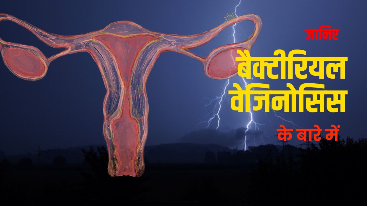 जानिए बैक्टीरियल वेजिनोसिस के लक्षण, निदान व उपचार क्या हैं