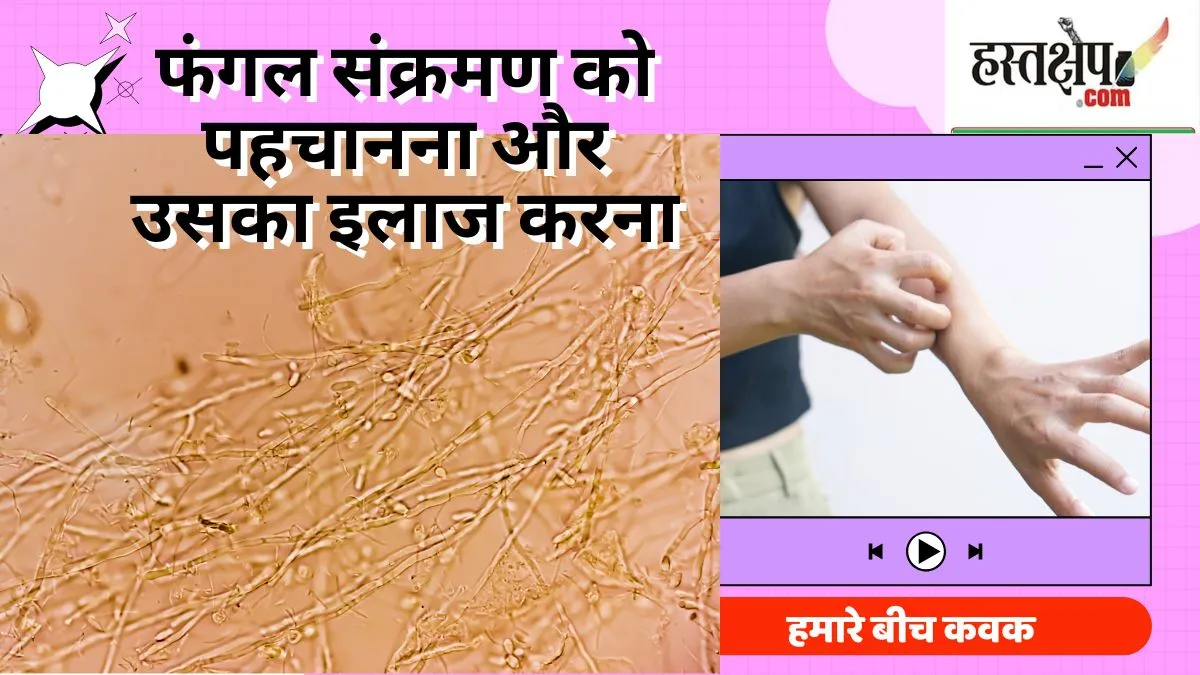 हमारे बीच कवक : फंगल संक्रमण को पहचानना और उसका इलाज करना हमारे बीच कवक : फंगल संक्रमण को पहचानना और उसका इलाज करना