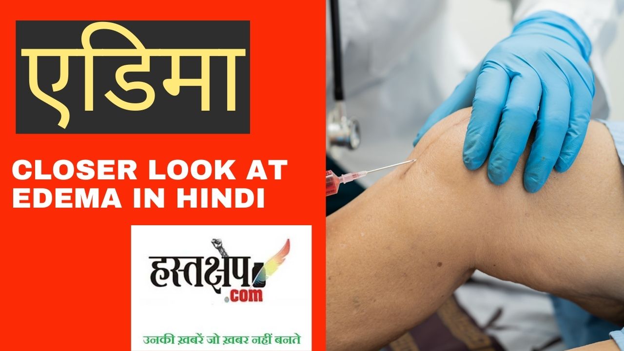 जब शरीर के अंग सूज जाते हैं : एडिमा पर करीब से नज़र रखना