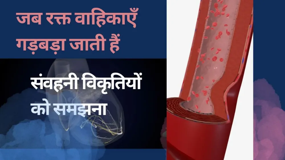 संवहनी विकृतियाँ (वैस्कुलर मालफॉर्मेशन): लक्षण, उपचार और दृष्टिकोण संवहनी विकृतियाँ (वैस्कुलर मालफॉर्मेशन): लक्षण, उपचार और दृष्टिकोण