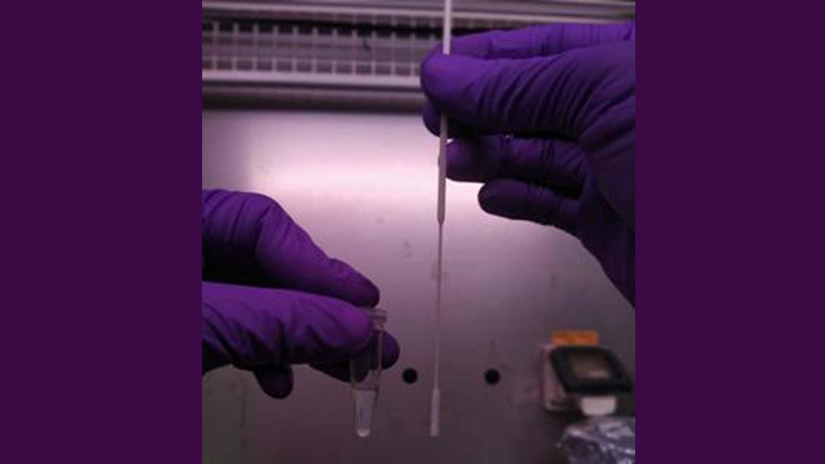 डायरेक्ट ड्राइव स्वाब आरटी-पीसीआर ; कोरोना परीक्षण अब दोगुनी गति से